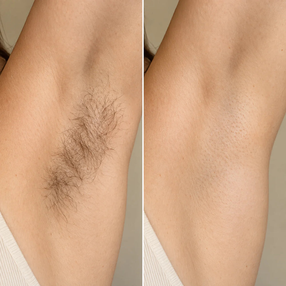 Lovelle Silk – Haarminimierendes Körperöl