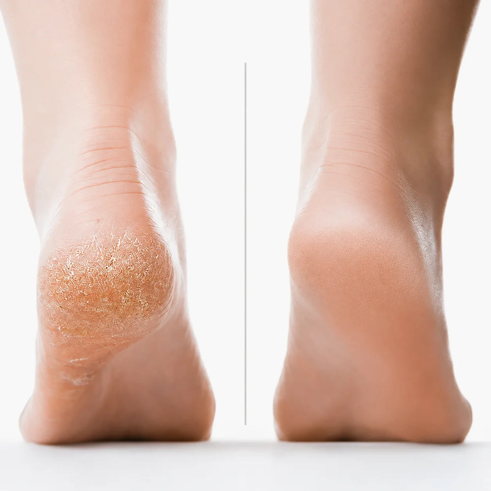 Lovelle Smooth Pro – Electric Foot File